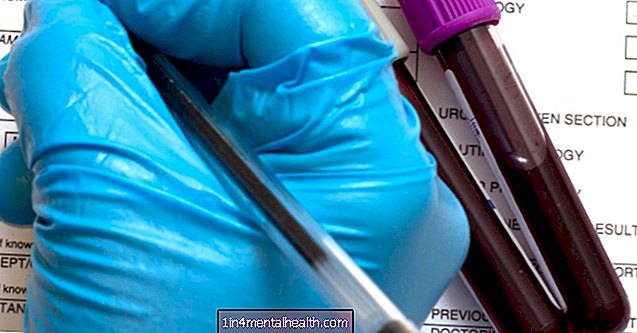 Ce este un test de sânge diferențial? - infecții ale tractului urinar