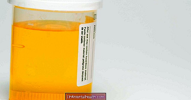 Hvorfor lukter urinen min som svovel? - urinveisinfeksjon
