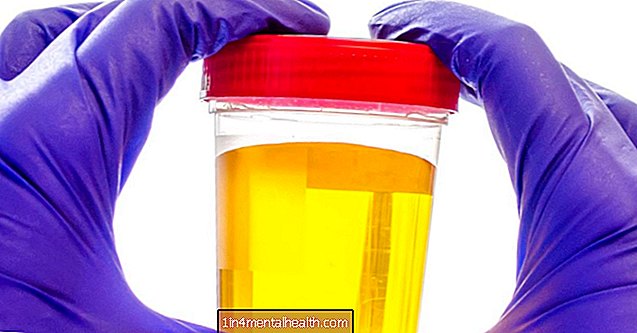 Hvorfor er urinen lysegul? - urinveisinfeksjon