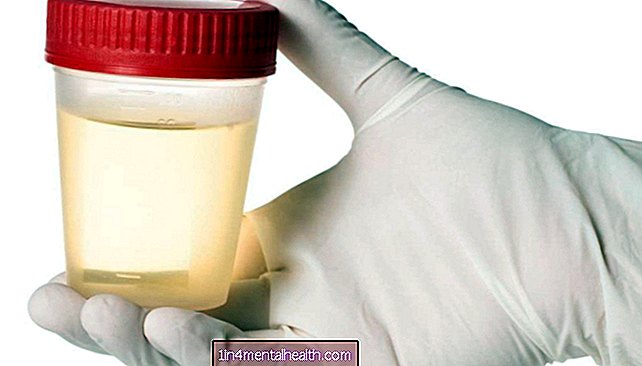 Miks mu uriin lõhnab ammoniaagi järele? - uroloogia - nefroloogia