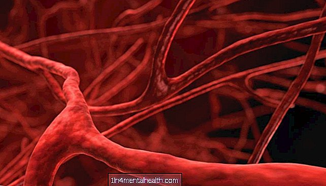 Како здравље крвних судова може утицати на КВЧБ - васкуларни